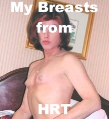 Hormone Induced Breasts