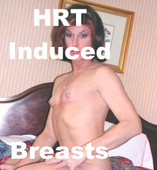 HRT Transsexual Breasts